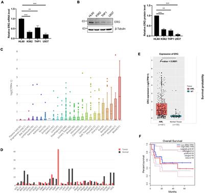 Hyper-SUMOylation of ERG Is Essential for the Progression of Acute Myeloid Leukemia